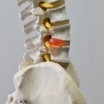 腰椎椎間板ヘルニアと自律神経の関係