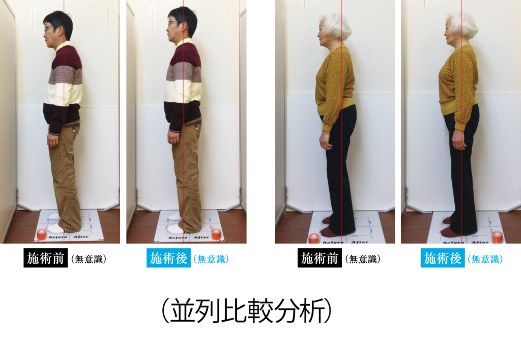 AI運動機能分析E.F.A.S(イーファス) 姿勢分析(並列比較)
